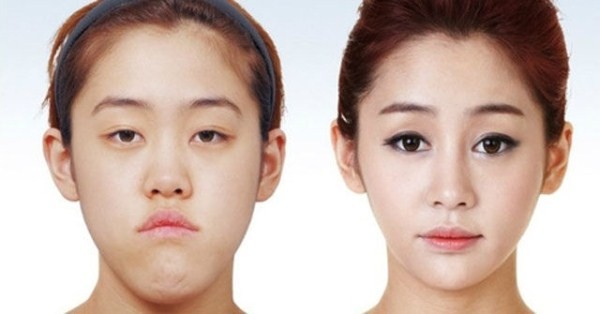 In 2012 their medical tourism industry raked in an eye-watering $453,000,000 - that's a serious number of Botox injections, collagen implants, eyebrow lifts and nose jobs.