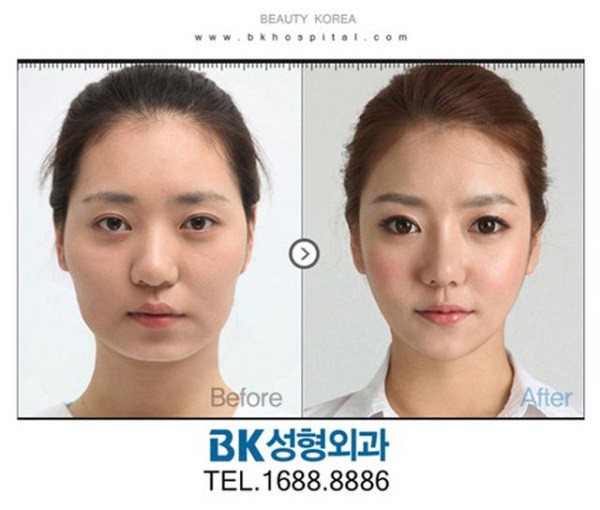 Or do you think the surgery is creating a production line of homogenised and uniformed faces, suspended in time, free from expression and bereft of character?