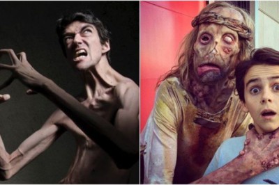 Genetik hastalıklarından dolayı korku filmlerinde yer alan aktör: Javier Botet