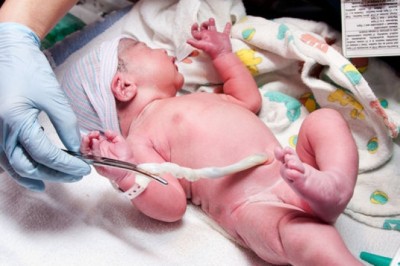 Göbek kordonunun kesilmesini geciktirmenin faydaları